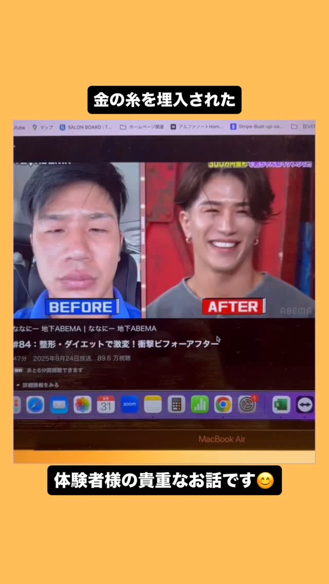 動画サムネイル